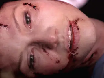their little family was destroyed  #greysanatomy #slexie #marksloan #lexiegrey #fyp #foryouu #greysanatomyedits #letdown #radiohead #foryoupage #viralvideos #greys #tiktok #fypシ゚viral🖤tiktok @Grey’s Anatomy ABC @TikTok   dts 🫶🏼: @slexiegreysloan @sophie @kenzie @caleb @meredithxderek_ @elisa ⸆⸉ @⋆.ೃ࿔*:･ 𝐞𝐥𝐢𝐬𝐚𝐛𝐞𝐭 @🎀 @april @gaby ୨୧  FAKE BLOOD, FAKE INJURIES, ITS A TV SHOW TIKTOK, DONT SHADOWBAN 