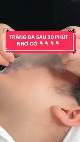 TRẮNG MƯỢT, SÁNG BÓNG SAU 1 LIỆU TRÌNH ✨ ✨Bạn đang mệt mỏi với làn da xỉn màu, không đều tone, sạm do nắng hoặc stress? 💧 Cấy trắng chính là “cứu cánh” dành cho bạn! 📍 Đây là video thực tế tại TSS GLOW-LAB, khách hàng đang trải nghiệm liệu trình cấy trắng dưỡng sâu – không đau, không xâm lấn – giúp: ✔️ Da trắng bật tone đều màu ✔️ Mịn màng, cấp ẩm tức thì ✔️ Mờ thâm, giảm sạm do nắng & nội tiết 🔥 Đặc biệt: Sau liệu trình, da có thể cải thiện rõ rệt từ buổi đầu tiên. Chất lượng liệu trình & sản phẩm độc quyền tại spa – CAM KẾT hiệu quả rõ ràng! ⏰ Ưu đãi đặc biệt tháng 6 – GIẢM 30% khi đăng ký hôm nay! 💌 Inbox ngay để giữ lịch và được tư vấn miễn phí!#viral #fyp #nthu_beauté #tss #lamdep #xuhuong #chuyennghiep #spaacademy #tssglowlab #spa #skincare #lamtrang 