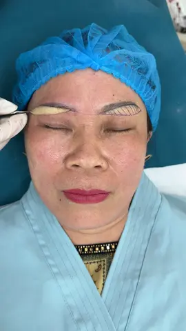Nâng cung chân mày giấu chỉ cải thiện mí mắt sụp #nangcungmay #nangcungchanmayrutchi #nangcungchanmay #xuhuong #ilovetiktok 