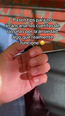 busco anillos anti estrés 