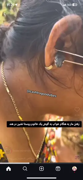 #snake 🐍 in woman’s #ear 