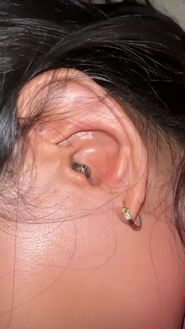Omg #ticks 