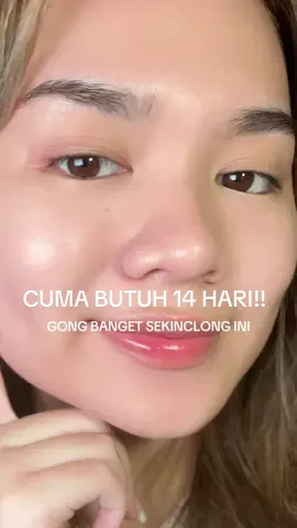 ternyat bener konten yang suka lewat kalo retinol tuh bisa ngecilin pori-pori 🫶🏻🤧 #RetinolViral #moisturizerviral #retinoid #retinol 