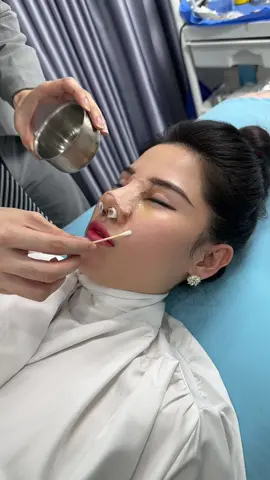 Dễ thở 😮‍💨 #eid #muitrunghoa #xuhuong #nâng_mũi_cấu_trúc_đa_tầng #thinhhanh #viralvideo 