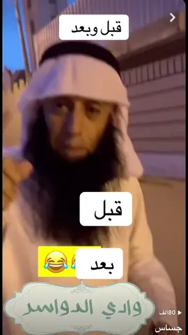 قبل وبعد 😂😂 #الانتشار_السريع_الطائف #الشيخ #التعدد #الزواج #اكسبلور #تردند_تيك_توك #لايكات #لايك_متابعه_اكسبلور #اكسبلور 