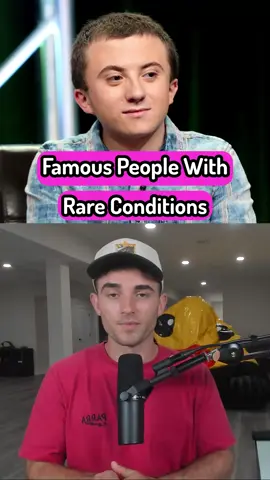 Famous People With Rare Conditions
