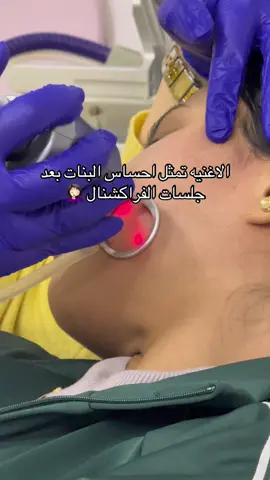 النتيجه تستحق الألم 🙆🏻‍♀️❤️😭😂‎ للتواصل والحجز ٠١٠٣٢٧٥٧٧٤٢ ‎العنوان 📍 بنها - الأهرام - شارع امن الدوله - امام موبينيل 🫶🏻 #fyp #f #fypp #peel #peeling #ليزر_ازالة_شعر #ليزر_شعر #تنظيف_بشرة_عميق #تنظيف_بشرة_عميق #تنظيف_بشرة_عميق #جلديه_و_تجميل #doctor #skincare #هيدروفيشال #ليزر #نضارة_البشرة #دكتور #مشاهير_تيك_توك_مشاهير #جلديه _العرب #خلايا_جذعيه #hyd #هالات #عنايه #laser #laserhairremoval #lasertattooremoval #ليزر_ازالة_شعر #fyp #ازاله_شعر 
