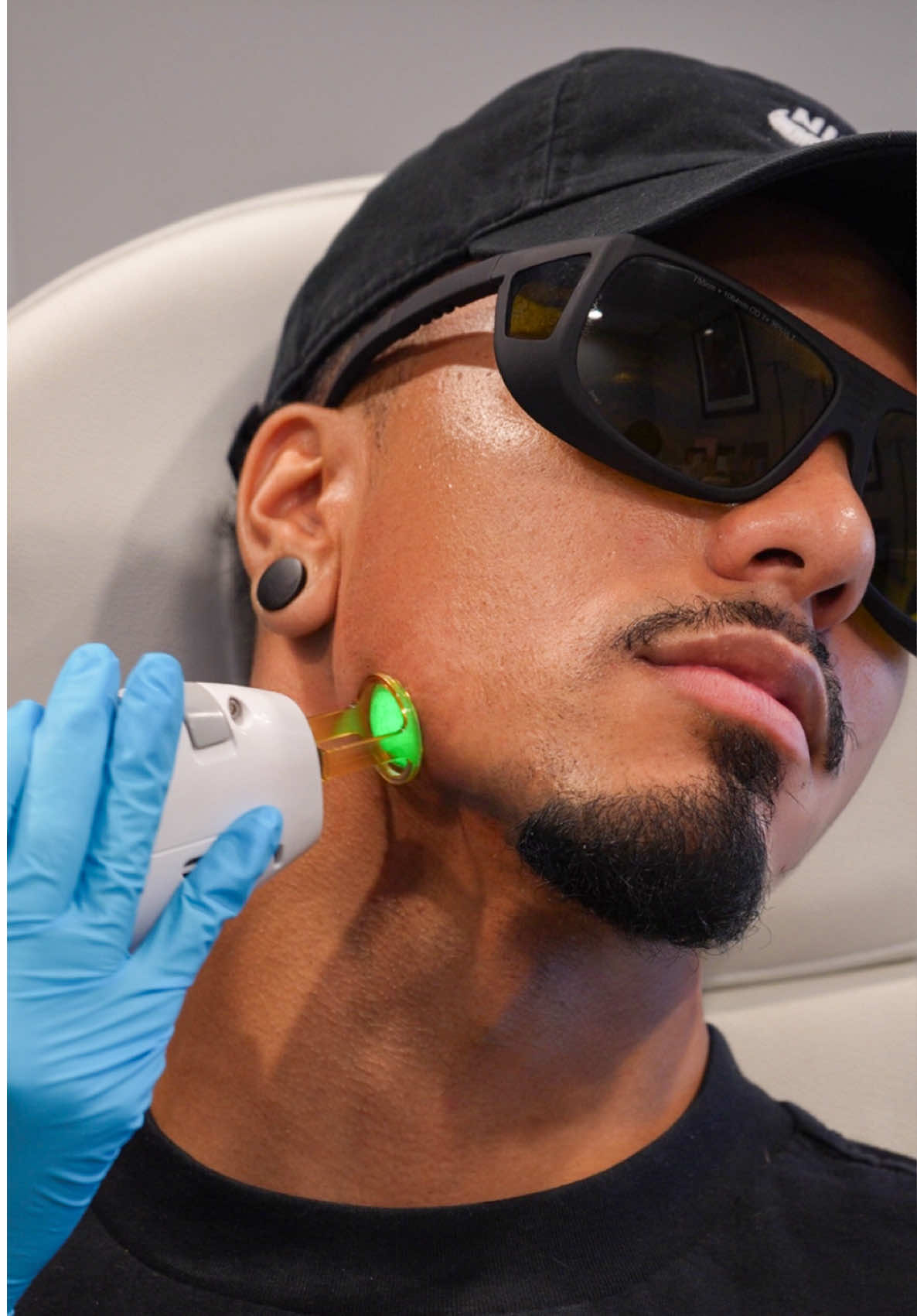 Just wrapped up my laser hair removal session on my beard with Reading Dermatology with @esthetics.by.yomaris and let me tell you, it’s a game changer!  No more razor bumps, irritation, or constant shaving. Smooth skin. Clean look. Less maintenance. Fellas, it’s time we start taking care of our skin too — and this is a solid first step. 💥 #LaserHairRemovalForMen #BeardCare #SkinGoals #ReadingDermatology #menscare