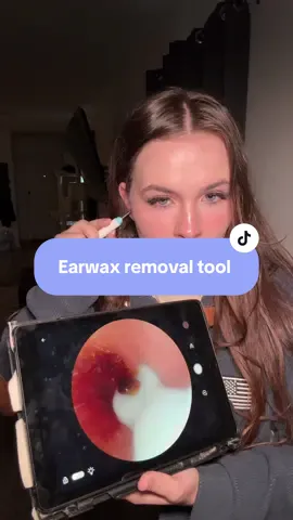 #earcleaner #earcleaning #earcameratool #earwax #earwaxremoval 