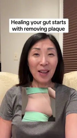 It turned out to be just that... #guthealth #bloating #flatstomachtips #flatstomach #guthealthmatters 