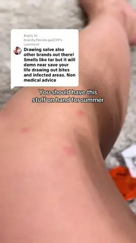 Replying to @brandy.florida.gal239 SERIOUSLY! This stuff is amazing for that! I always have it on hand for spider bites  #hylands #hylandsprid #prid #pridsalve #drawingsalve #spiderbite #ingrownhair #ingrownhairtreatment @Hyland's 