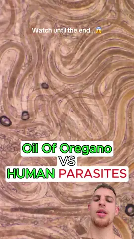 #interesting #microscope #parasites #gutcleanse #oiloforegano #greenscreenvideo  