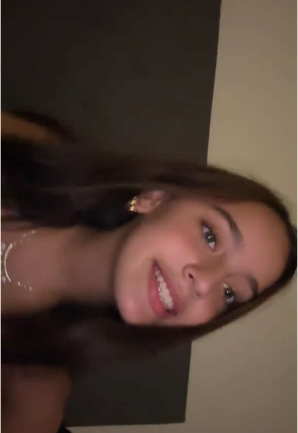 🦷🦷 #bracesfree