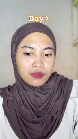 Sesuka itu ekspo karena bikin kulit lebih bersih🤏🏻❤️‍🔥 #peelingserum #elsheskin 