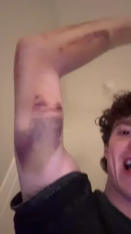 that feeling when elbow surgery is tomorrow