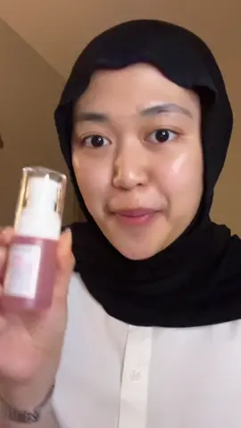 pokoknya kalo kalian lagi struggle sama wajah belang dan dark spots yang ga ilang ilang, cobain deh ni niacinamide serumnya skinitip, ato kalo mau lebih ampuh pake masker ama moistnya sekalian wkwk😭🤌🏻