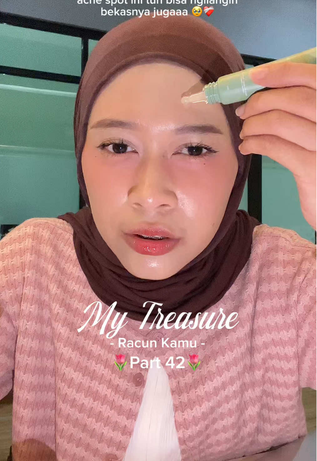 Siapapun makasi banyak yaa, formulasinya mantep banget demi apapun😭💖 #corporatelife #saatnyaReglow #MyTreasureReglow #acnespotgelreglow 