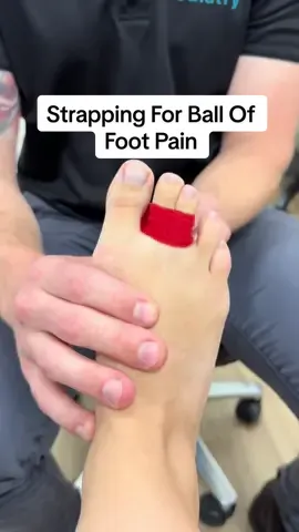 This taping can be used for any pain in the ball of the foot. This could include plantar plate injuries, bursitis or metatarsalgia. By taping the toes down, we reduce pressure onto the metatarsal heads which can decrease pain and improve function. Coupled with a metatarsal dome to redistribute force, this taping can really reduce your discomfort. Cut your strip of k-tape in half so it isn’t too thick. Place it around two toes and apply pressure to flex these toes down. Cross the tape over under the feet and repeat with a second strip to increase the support. Give it a try and let us know how you go! #podiatry #brisbanepodiatrist #footpain #taping #heelpain #feet #plantarfascitiis #strapping #footcare #painrelief #bursitis #Running #archpain #podiatrist 