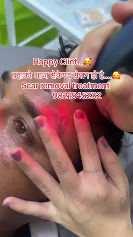 #happy #clint #scar #removal #treatment #pigmentation #wrinkles #acne #skincare #pigmentation #wrinkles #acnetreatment #skincare #fyppppppppppppppppppppppp #foryoupage #goviral 