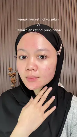 Fyi untuk metode sandwich ga selalu untuk pemula ya, kalau kalian udah biasa pake retinol dan pengen lebih intens lagi bisa pake moist yg ada kandungan retinol juga. Dan jujur pas gue pake moist retinol you + serumnya bnr bnr ga ada iritasi sama sekali dan malah bikin bagus di kulit gue 🥹🫰🏻 #yourskinrefinement 