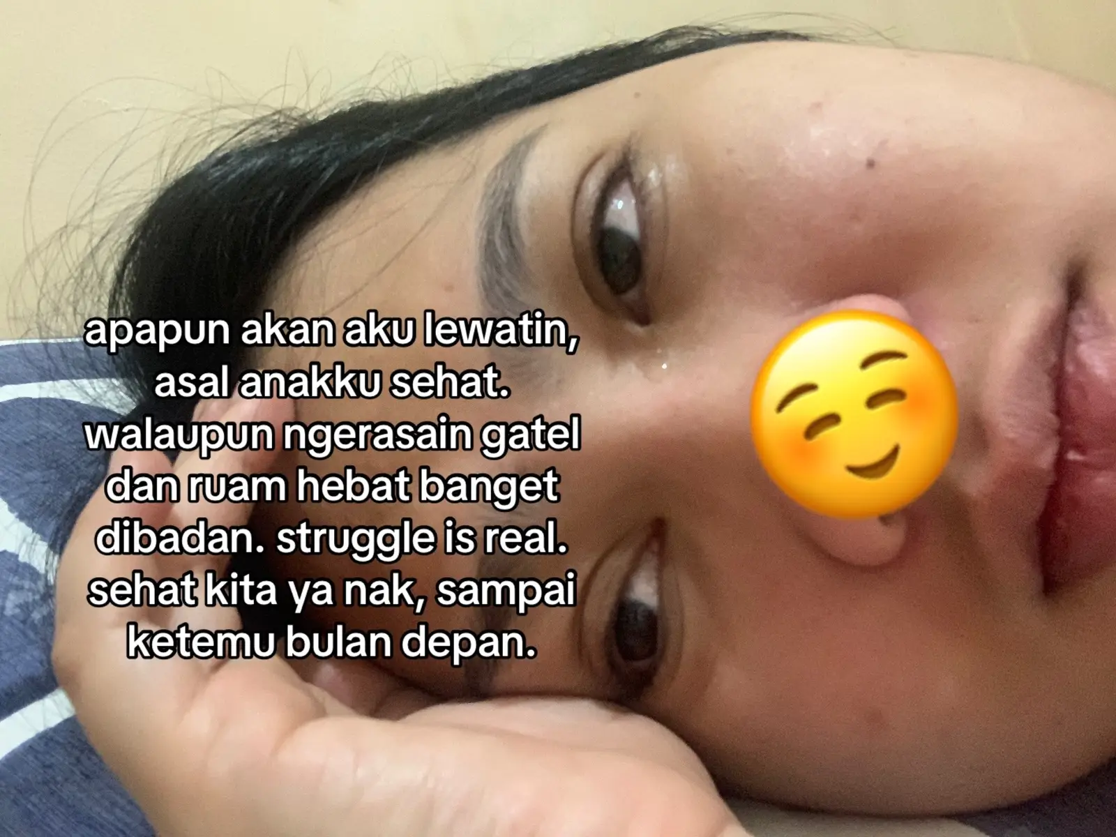 ada yang bilang ini penyakit ibu hamil trimester akhir namanya PUPPP (tapi ngga semua bumil kaya gini kok) udah berobat ke dr kulit juga, tapi masih belum ngaruh. katanya obatnya cuma lahiran 😂  #trimester3 #perjuanganibuhamil 