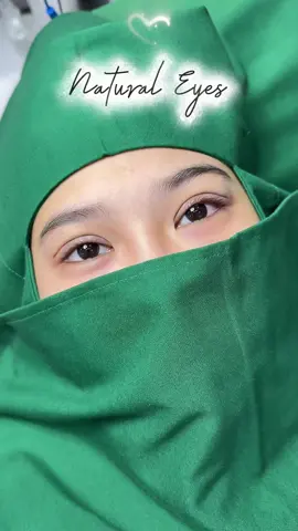 Nhấn mí Xinh chỉ 4 củ5 thoaiii nha. Đăng kí ngay nhận ưu đãi tại Pk THUÝ LÊ #ThuyLeClinic #PhongKhamThuyLe #CatMiTuNhien #NangNgucMentor #PhauThuatAnToan #ComboMatToTron #DepKhongCanFilter