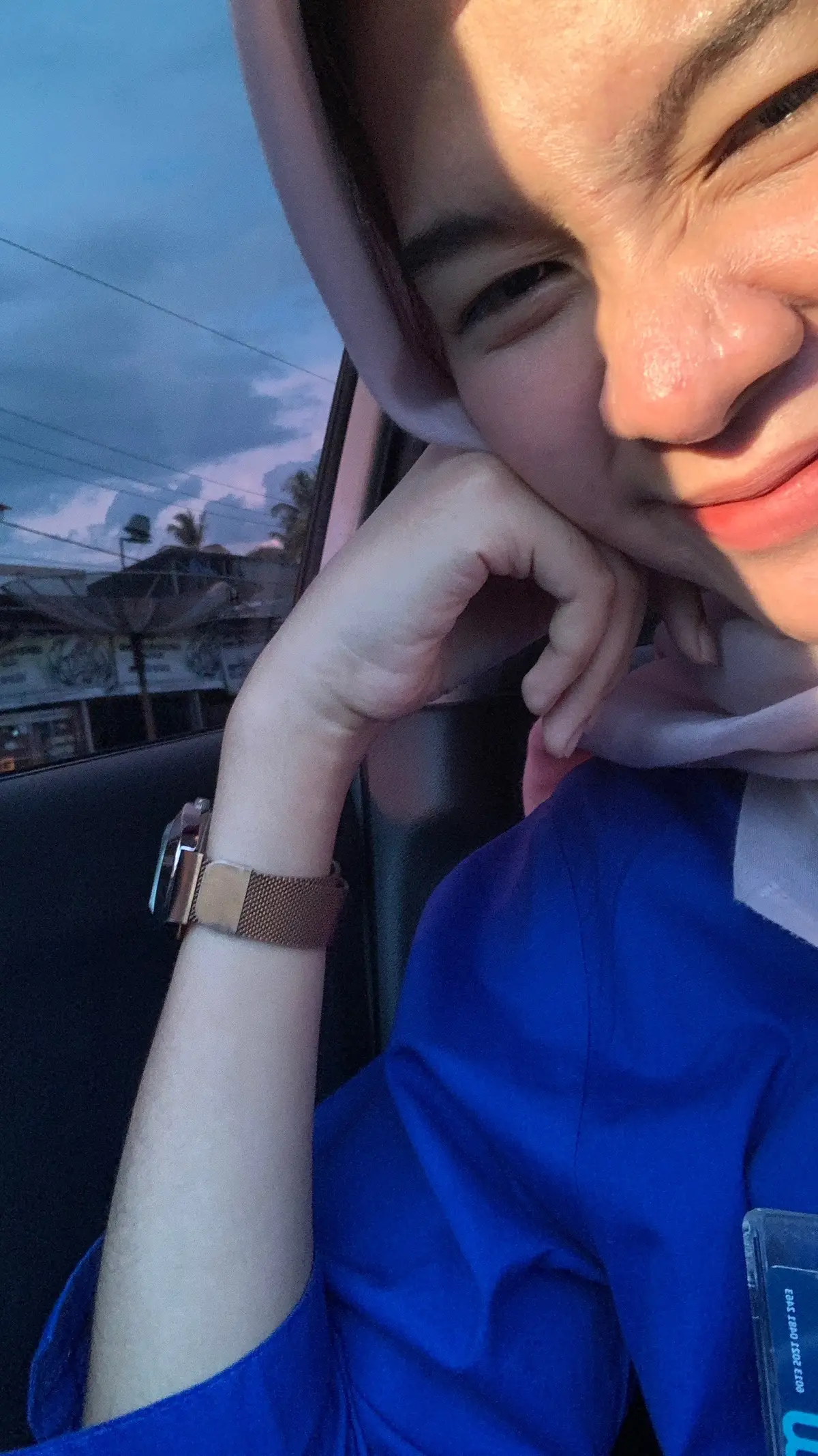 tetap senyum walau mata iritasi 😵‍💫