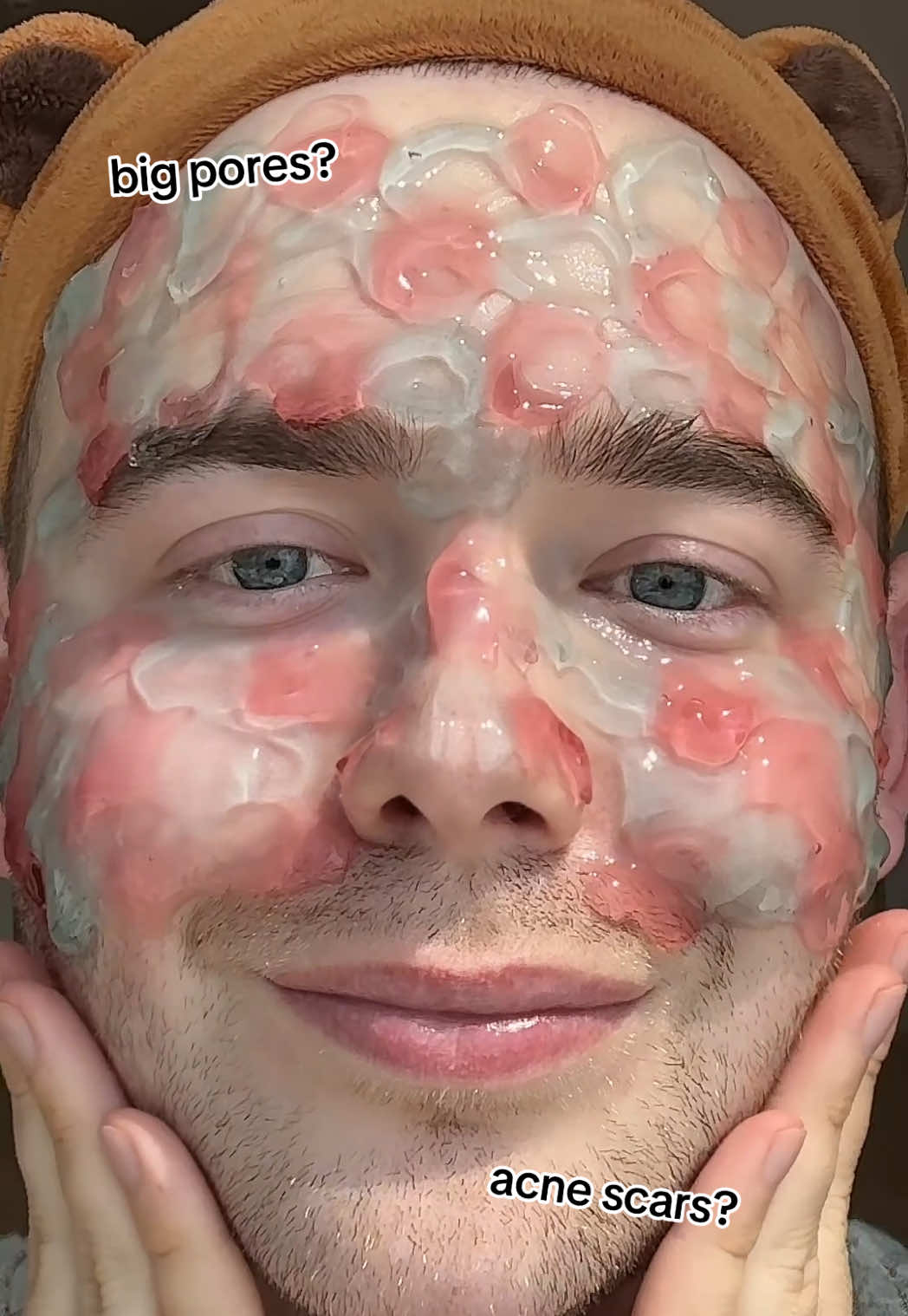 Okay but why did I play serum chess on my face before bed? 💀 ad @Arencia   Arencia Holy Hyssop Serum 30 = for acne scars 💙 Arencia Red Smoothie Serum 30 = for tightening pores ❤️ Because I refuse to pick one struggle when I can treat both 👏 #arencia #skincare #acne#glassskin #tightpores 