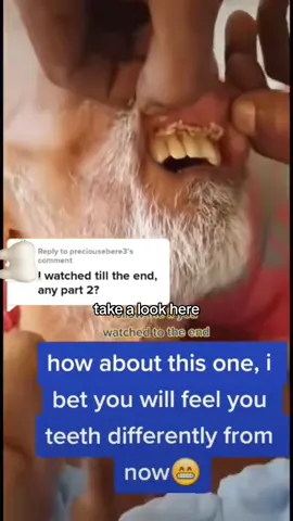 Flies flying in the mouth 👄?! 