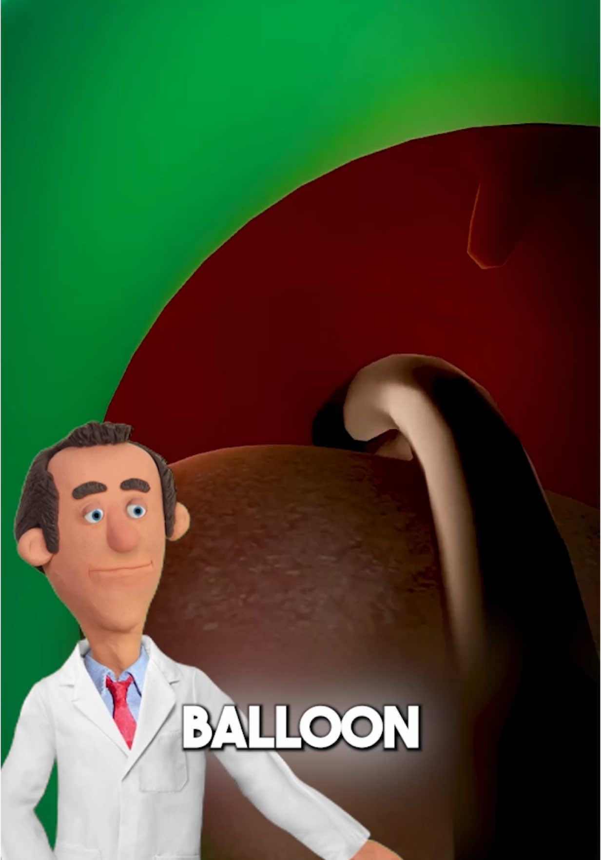 What is a gastric balloon? #doctor 