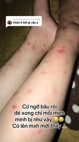 Trả lời @Thụ8998@ cứ ngỡ chỉ có mình mình thôi :(( ai ngờ nhiều b giống mình 🥲 #tritham #trending #xuhuong #fyp #sausinh #thaydoibatngo #viral 