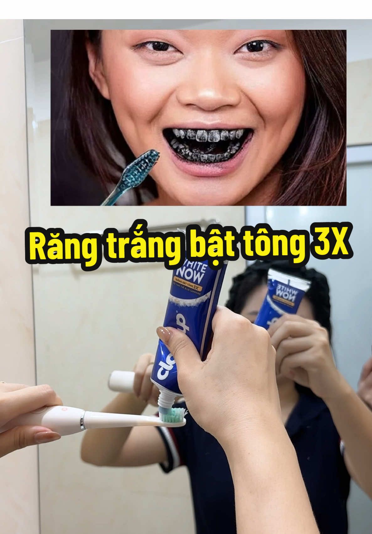 Răng trắng bật tông trông thấy #namireview #closeupwhitenow #closeup #lamtrangrang #kemdanhrang 