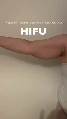 HIFU + Arms 🤝 My client's  results will continue to improve over the next 12 weeks as new collagen and elastin form. Book now to lift, tighten, and target unwanted fat on your arms. Message me to get started! x #perthhifu #hifu #looseskin #perth 