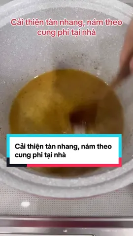 Cải thiện tàn nhang, nám theo cung phi tại nhà #luongytuetam #tuetamlaphuongdi #nam #tannhang 