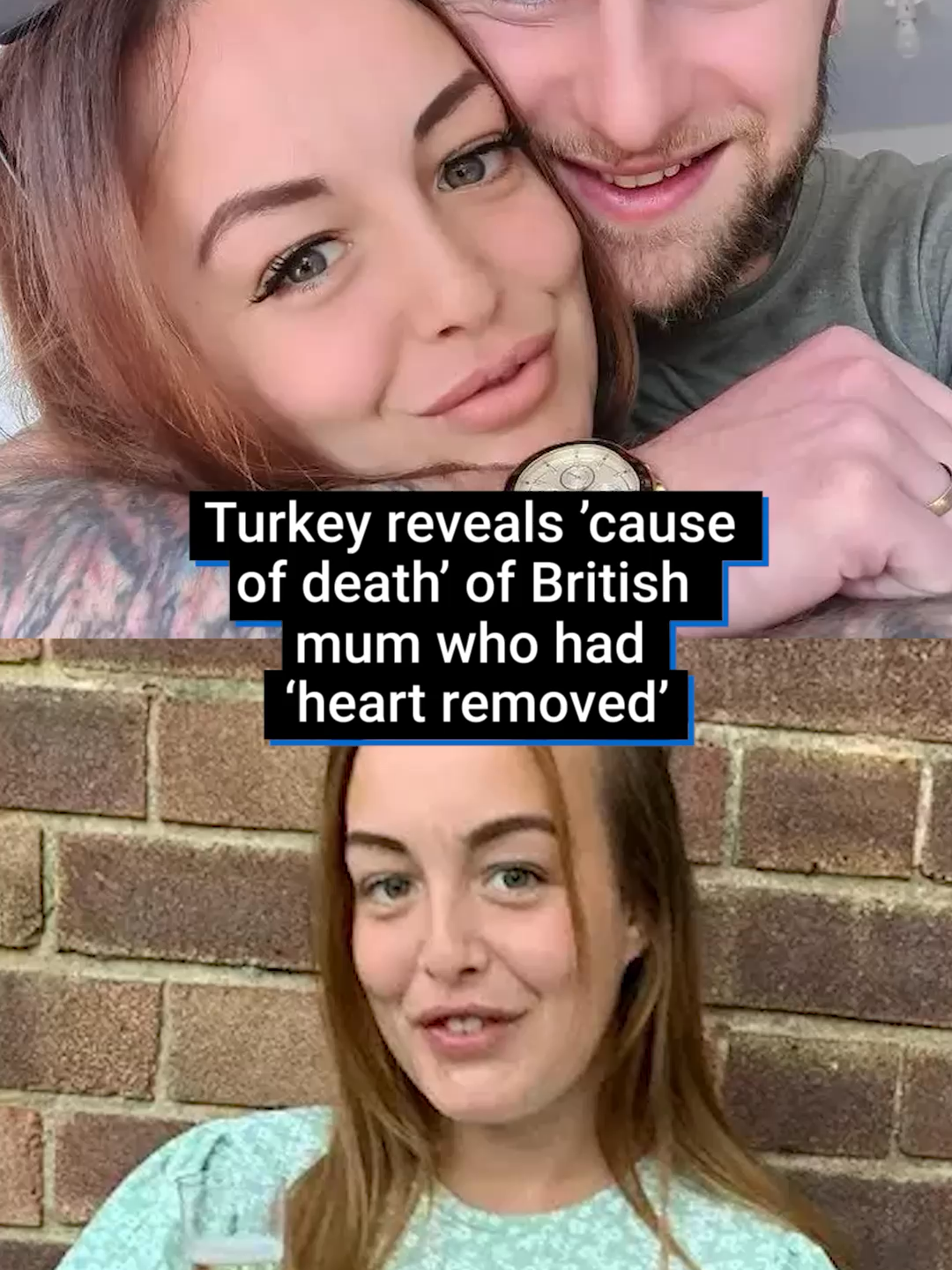 The cause of death of a British mum whose heart was ‘secretly removed’ during a family holiday in Turkey has been revealed. The Turkish medical examination report says Beth died as a result of ‘food poisoning’ from something she ate before arriving in Turkey. The report added that her heart had undergone a thorough examination, and all tissue samples of the heart and other organs examined will be delivered to the UK. The family suspect Beth’s death may be linked to a missed heart condition or an allergic reaction to penicillin, which they claim was administered to her despite her being allergic. #turkey #istanbulholidayguide #medicalnews #uknews