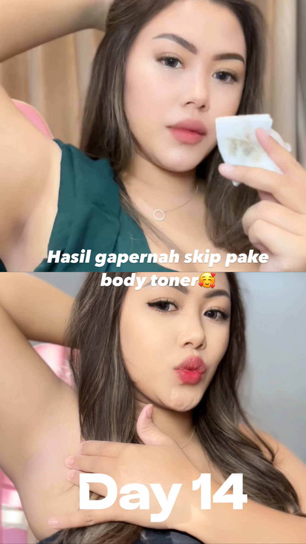 Hasil rutin pake body tonernya @Brighty Indonesia 🥰 emang mantul banget👏🏻🫰🏻 #toner #tonerketiak #tonerbadan #glycolicacid #brighty