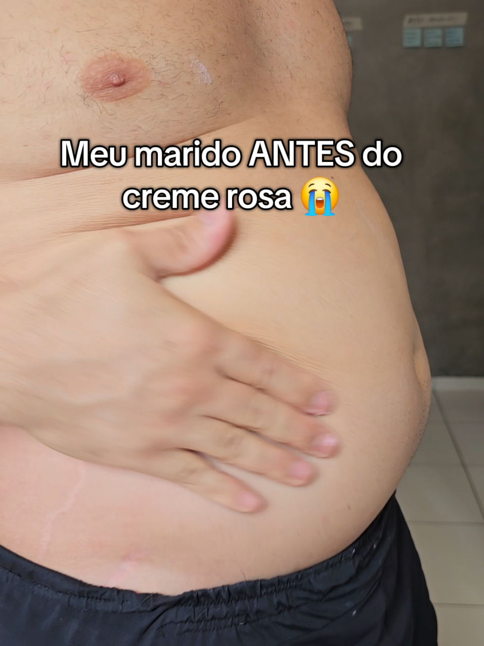 2 versões completamente diferentes. Esse creme rosa tá eliminando todo o bucho mole do meu marido #estrias #flacidez #mulherbrasileira #barriga #pov #mulher #lipedema #autoestima #lipedema #lipedemaabdominal #autocuidado 