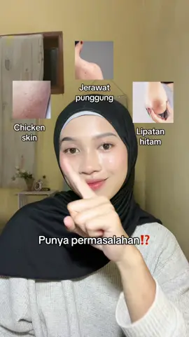 Hempas semua permasalahan kulit 💓 @Rintik Skincare Indonesia #nobumplotion #rintikskincare #fyp #recommendations #affiliate 