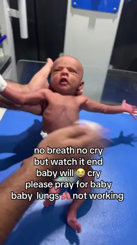 no breath no cry 😭 please pray for baby #usa🇺🇸 #ukraine🇺🇦 #uk. 🇩🇪 itly 