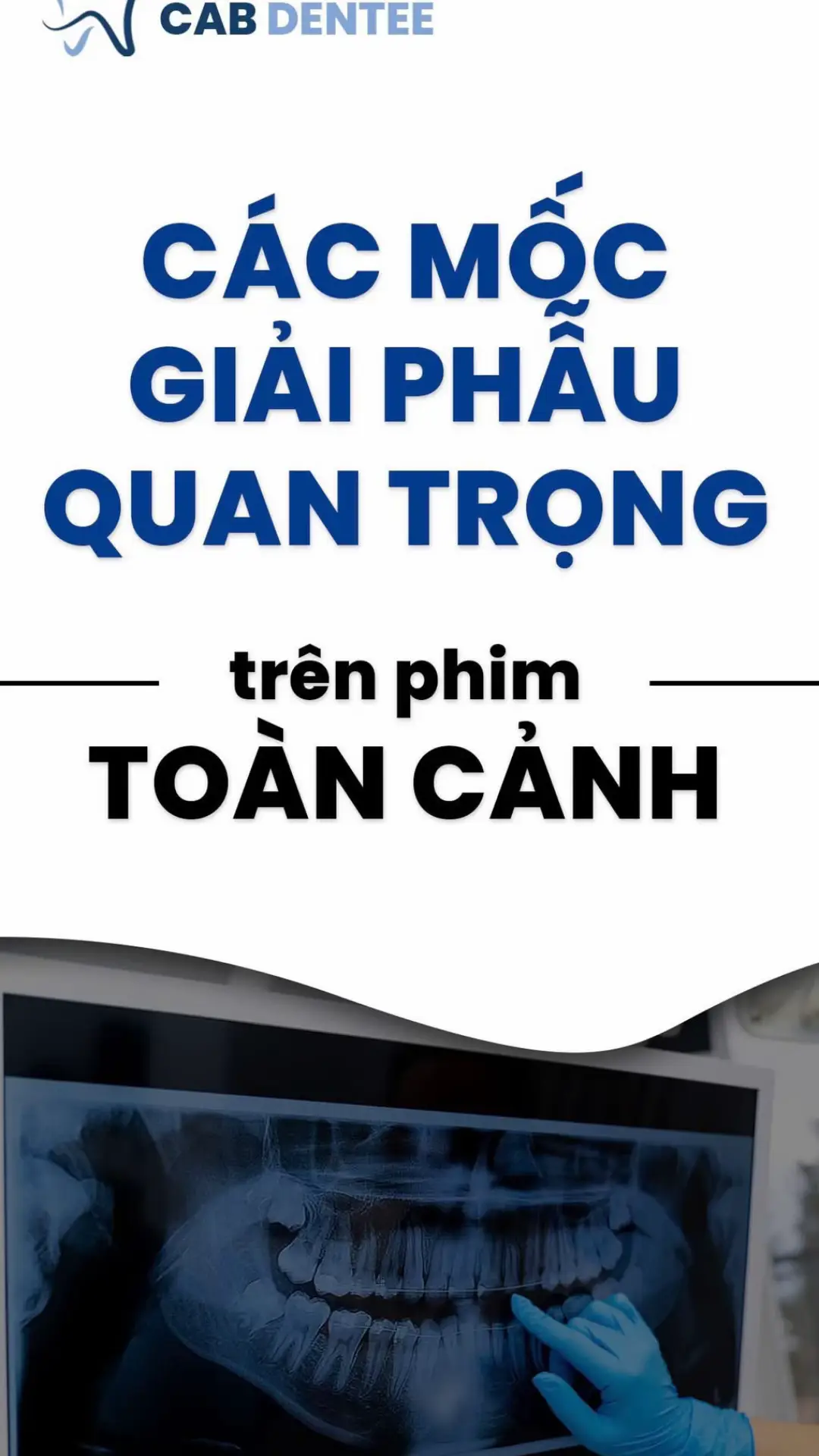 #cabdentee #ranghammat #sinhviennha 