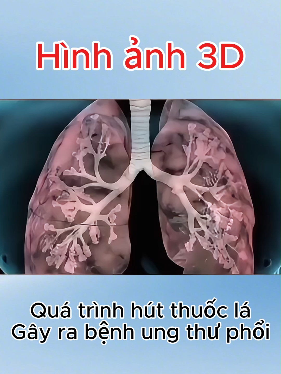 Quá trình hút thuốc lá Gây ra bệnh ung thư phổi#xuhuong#ungthu #ungthuphoi