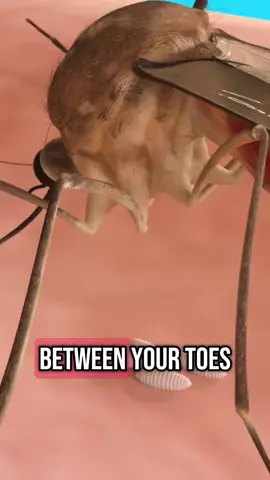 how botflies get between your toes 🤢#usa #usa_tiktok #foryouu #interestingfacts #DidYouKnow #american #americanfacts #uktiktok #original #LearnOnTikTok #foryoupage #trending #zackdfilms #knowledge #3danimation #fyp #facts #viral