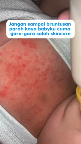 Peringatan buat semua moms untuk lebih hati-hati dalam memilih skincare baby :( #hiboo #babyskincare #skincareanak #babybalm 