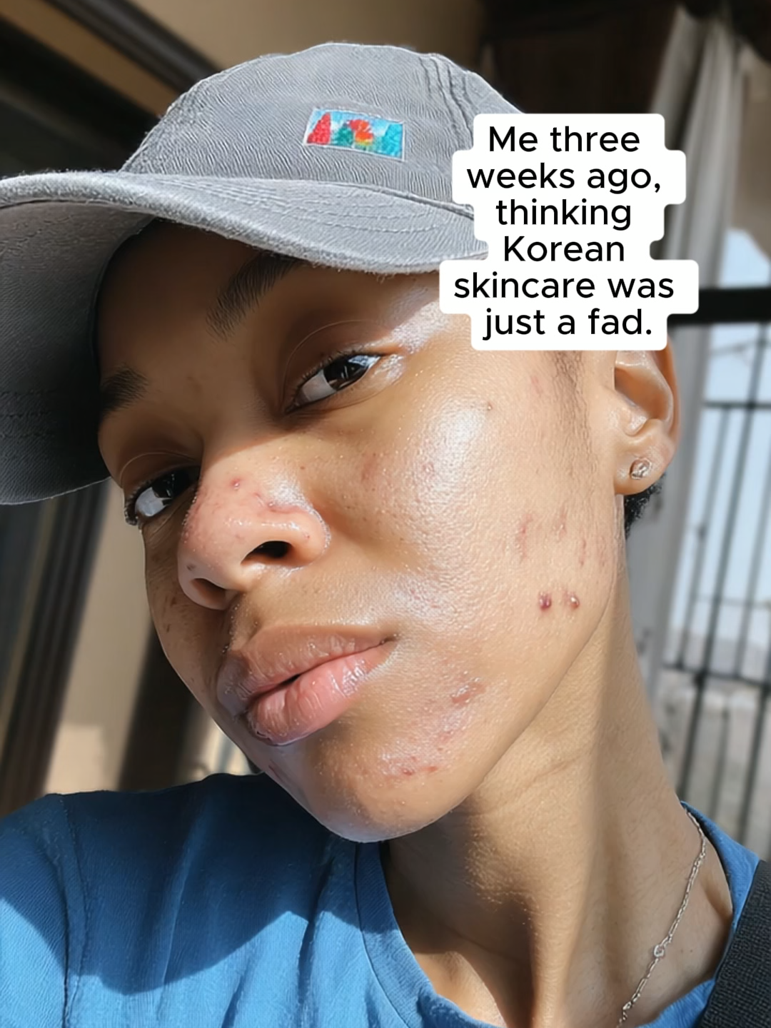 the CLEAREST SKIN i have ever had... THANK YOU #jiyu! #koreanskincare #kbeautyskincare #jiyutonerpads