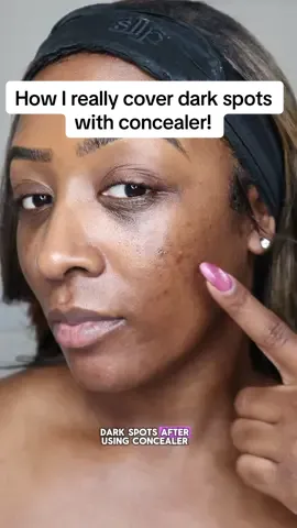 Dark spots peeking through? This concealer trick changed everything 😮‍💨 #makeuphacks #darkspot #concealertips #makeupforbeginners #flawlessbase #makeupmistakes #blackgirlmakeup 