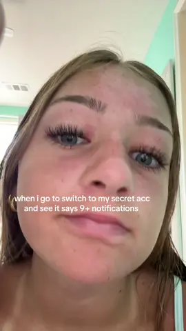 like hi im famous #foryoupage 