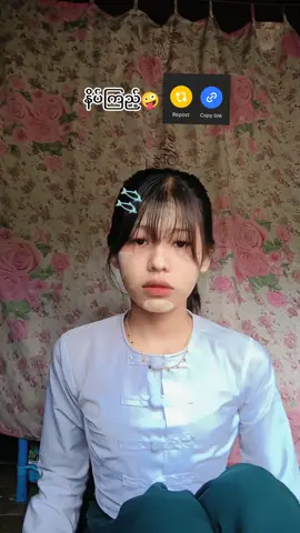 #ရို့ရို့😜🤭 #မေ့နေကြပီလား😪😪 #မေ့နေကြပီလား😪😪 