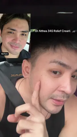 Dra Althea 345 Relief Cream 