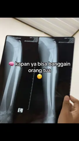 #fyp #fyppppppppppppppppppppppp #bahanswmu #setorywa #tanganpatah #patah 