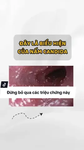 Đừng bỏ qua các triệu chứng này #ladyfar #muoivesinhladyfar #muoivesinhphunu #ddvs 